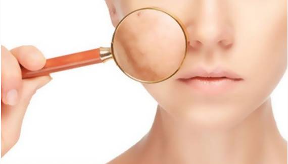 俄罗斯专家注射细菌抗衰老,抗衰老的细菌