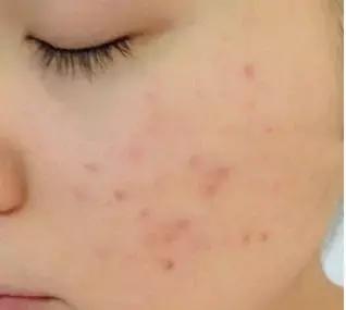 肌肤较干秋冬精华,秋冬不粘腻的精华水