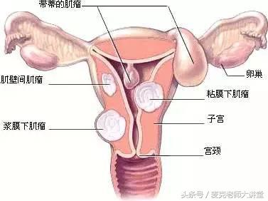 每个女人都应该做妇科检查,收藏女性都需知道的妇科检查知识