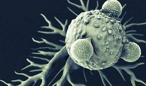 夺走高仓健、罗京的淋巴瘤，究竟是什么鬼？（附三甲医院名单）