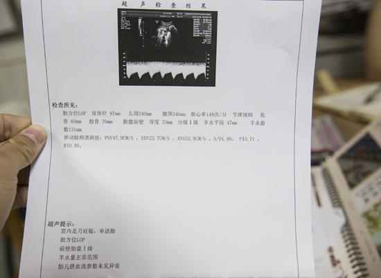 教你看懂孕b超单,孕妈妈如何看b超单