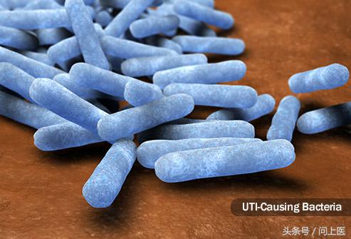 尿液哪个指标可以看出肾功能异常,尿液异常原因有哪些