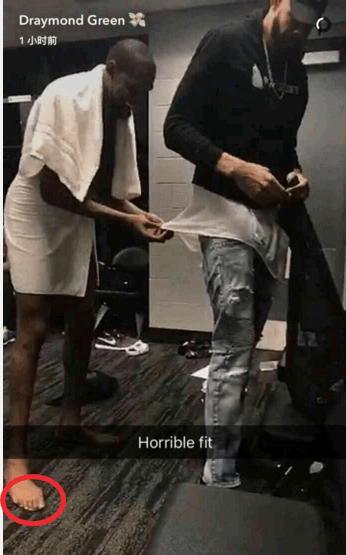 看脚就知道他们为什么是球坛巨星,詹姆斯完全变形,C罗脚趾发肿