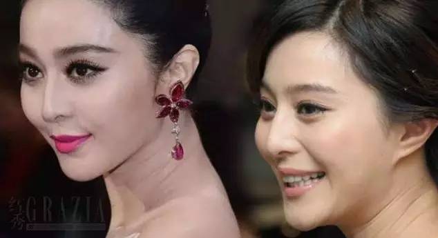 一条颈纹老十岁教你一招淡化,年纪小就有一条很深的颈纹