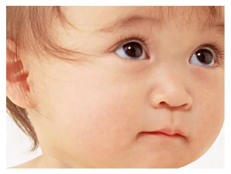 新生儿0-1个月护理脸部,新生儿常见皮肤疾病及护理