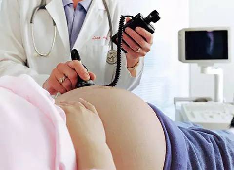 孕期要怎么做才不长妊娠纹,孕期如何做有利于生产