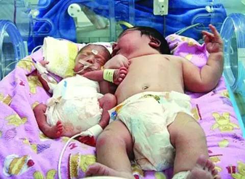 孕期要怎么做才不长妊娠纹,孕期如何做有利于生产