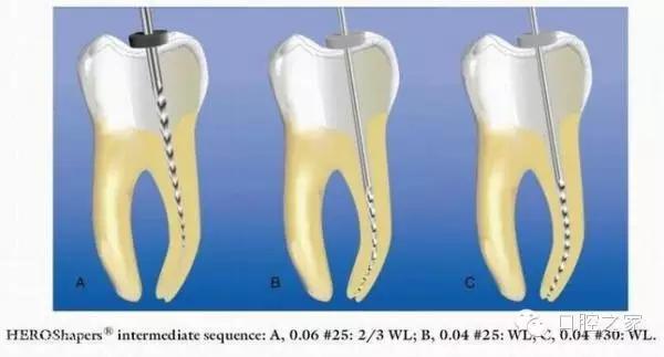 根尖脓肿反反复复治疗方法,牙根尖炎反反复复会不会癌变