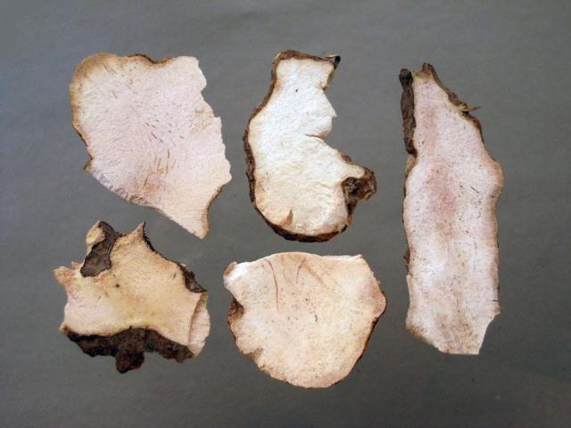 尿酸性肾病中医治疗心得,尿酸性肾病中医医案