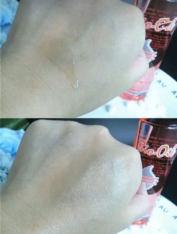 深扒“网红”神油,8周改善妊娠纹和疤痕~