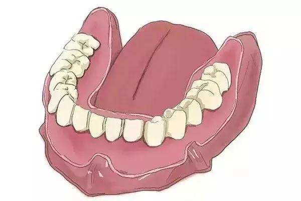 缺牙是种植牙还是烤瓷牙好,烤瓷牙和种植牙哪个保持时间长