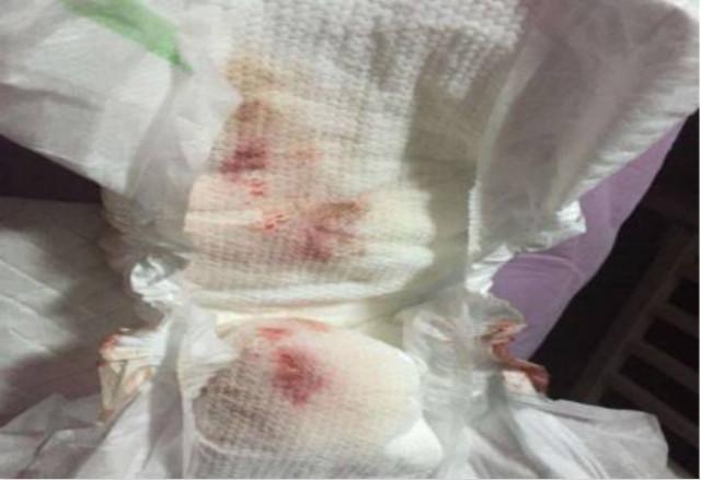 女婴儿九个月有假例假吗,女婴假月经一般几天