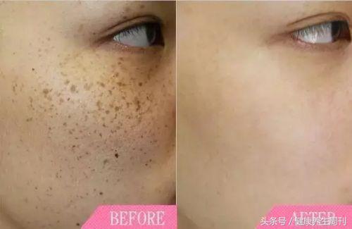 女子为变美做整形,女子为了美整容失败