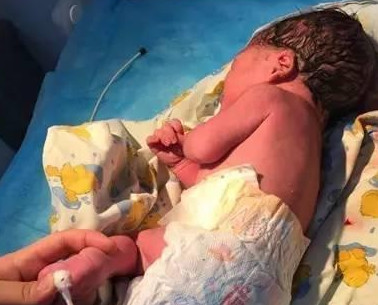 生孩子到预产期没动静该怎么办,孕产遇到的各种问题