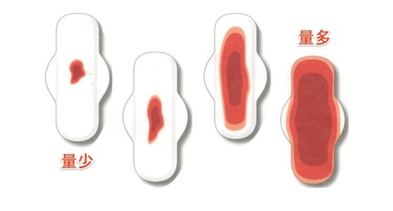 产后月经量少吃什么药调理,产后月经量少的调理药方