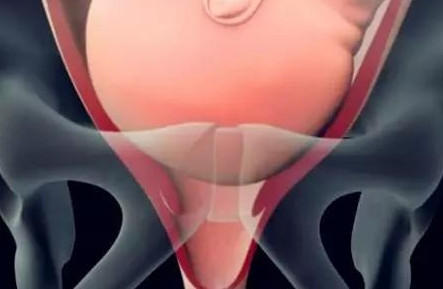 胎儿那么大怎么生出来,顺产胎儿怎么从产道出来