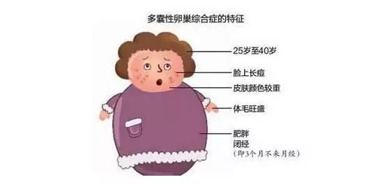 月经不正常肥胖一般是多囊吗,肥胖但是没有多囊会导致不孕吗