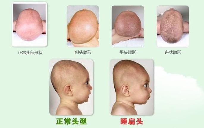 如何判断宝宝头型看这一篇就够了,宝宝头型不圆润有棱角