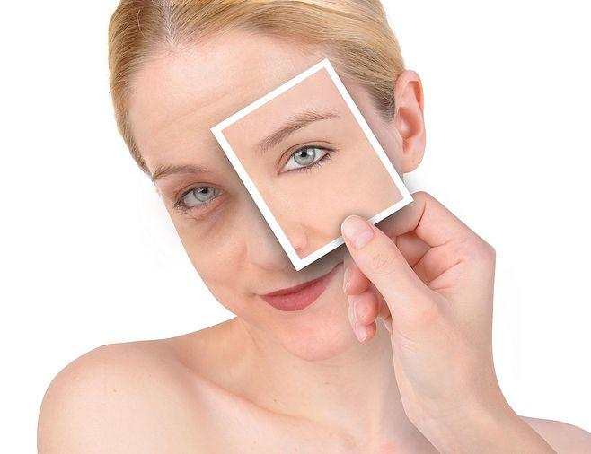 使用眼霜怎么消除假性眼纹,眼纹护理小窍门