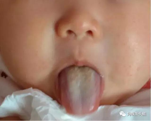 黄帝内经眼袋描述,黄帝内经如何治疗眼袋下垂