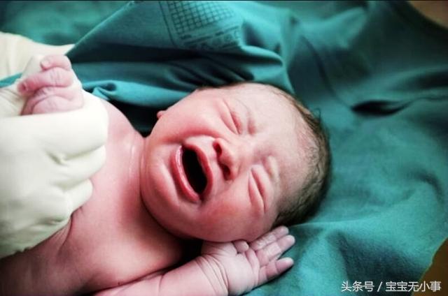 宝宝出生10天后，出了很多眼屎眼泪，医生：这与剖腹产大有关系