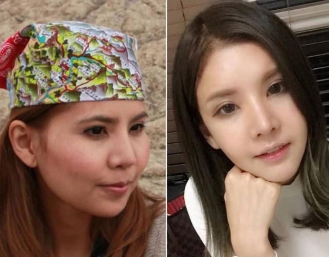泰国丑女花费700万,泰国丑女整容