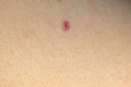 打完疫苗洗澡了对疫苗有什么影响,打完第三针疫苗多少时间可以洗澡