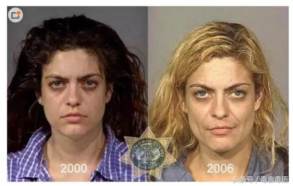 10个吸毒前后的惊人变化,吸毒的人吸毒前后对比图片