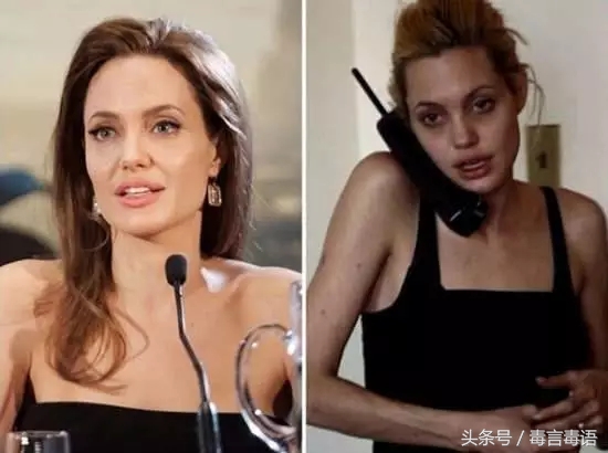 触目惊心吸毒前后真实的变化,吸毒的危害到底有多严重图片