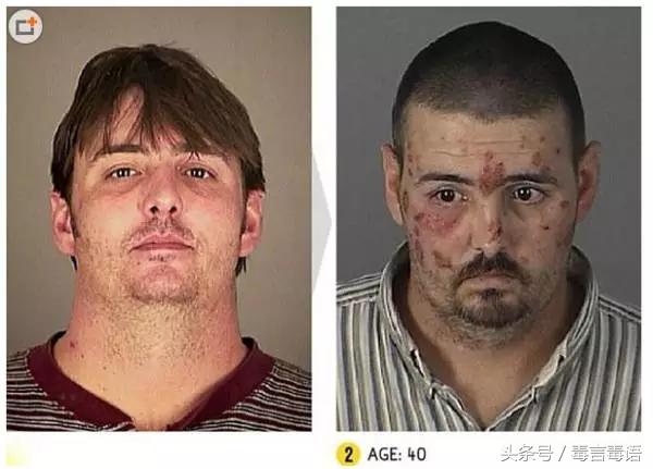 触目惊心吸毒前后真实的变化,吸毒的危害到底有多严重图片