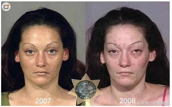 触目惊心吸毒前后真实的变化,吸毒的危害到底有多严重图片