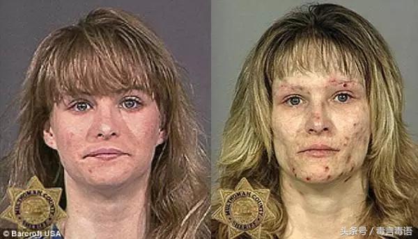 吸毒前后的变化对比,吸毒真的会毁容吗