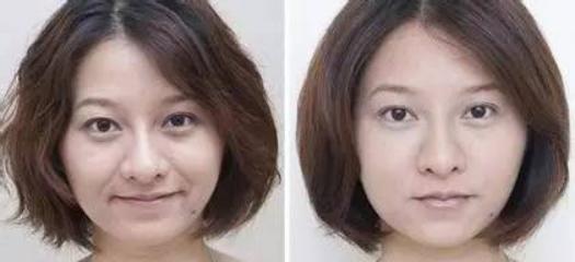 超声刀能去除法令纹吗,热玛吉祛法令纹好还是超声刀好