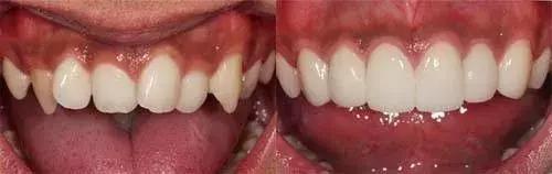 美容冠美白,一周快速脸部美白小妙招