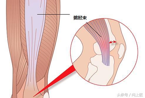 老年人膝盖疼痛的原因和治疗方法,膝盖疼痛的原因和解决方法