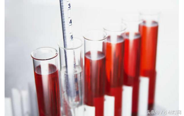 ivd应用领域分析,ivd产品知识