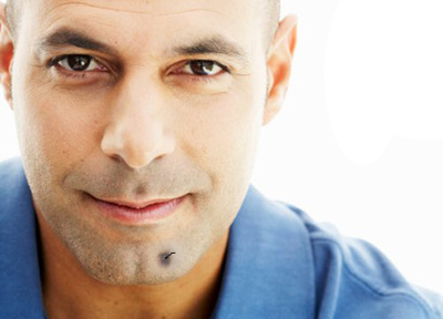 下巴有痣痣上长毛代表什么,痣上长毛了是什么原因