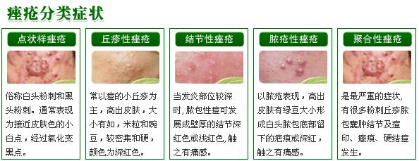 面部痘痘认知,痘痘的认知