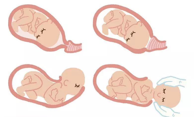 月安馨小课堂顺产和剖腹产哪个更痛？谁生谁知道！