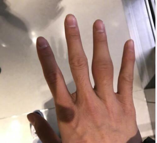 看完郭艾伦的手、詹姆斯的脚、刘翔的跟腱，大家就知道何为伟大了