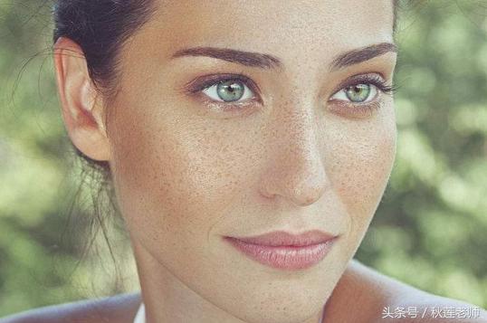 长雀斑是什么原因引起的怎么预防,雀斑是怎么形成的怎样淡化雀斑