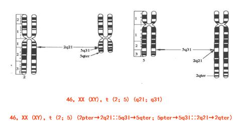 染色体异常的胎儿一定要打掉吗？