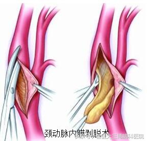 中年人半边身体麻木怎么回事,人到中年眼花