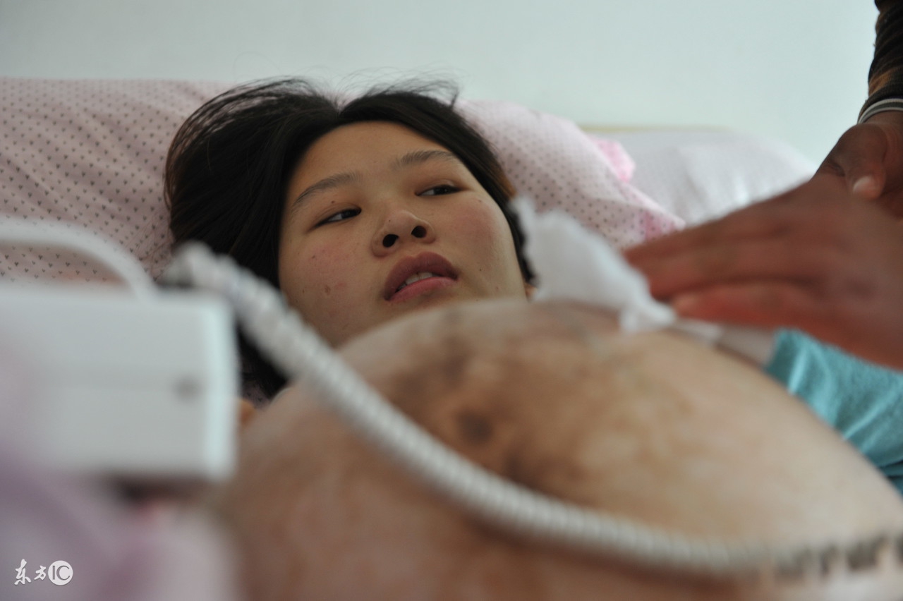 妊娠痒疹止痒秘方,有关妊娠痒疹的相关知识