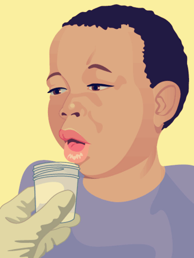 咳嗽时会咳出饭粒一样的东西,咳嗽好后一直有痰会自愈吗