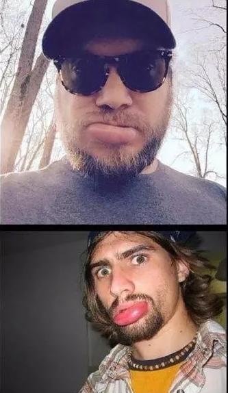 哈哈哈，原谅我拖拉机般的笑声！当喵星人被蜜蜂蜇了之后