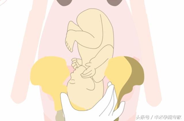 怎么理解胎儿入盆和开宫口