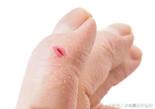 三甲医院通用的《疾病先兆自查表》,我用了几十年,现在还在用!