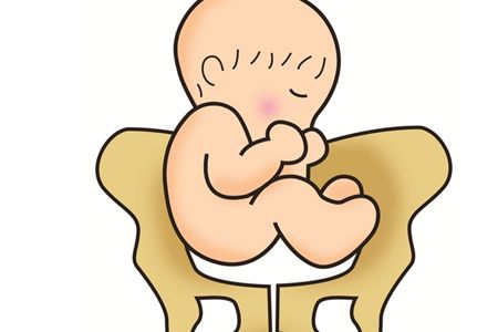 产科夜班之遇上不产检的急诊孕妇