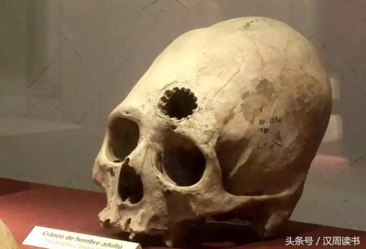 他用一根长钉从眼眶锤入那个人的头颅竟只为了治精神病